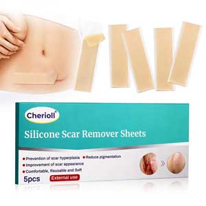 Professional Silicone Scar Removal Sheets